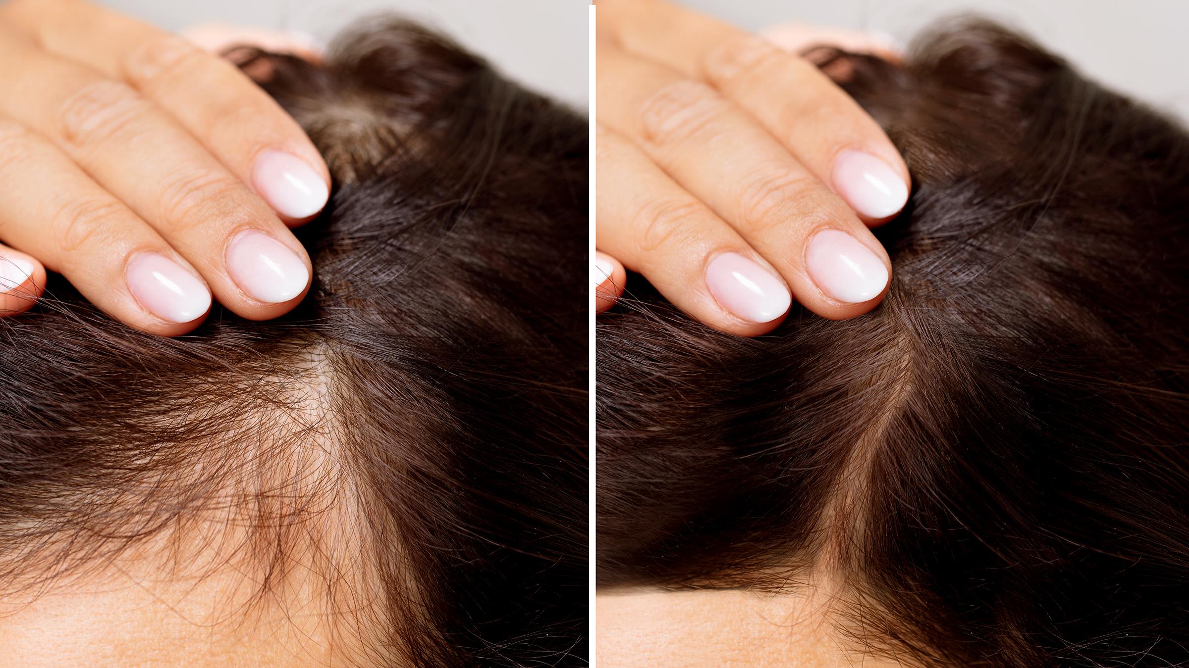 Top 12 Effective Tips to Stop Hair Loss and Regrow Hair