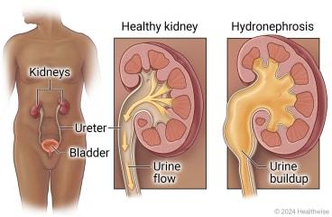 Simple Daily Habits That Naturally Enhance Urine Flow