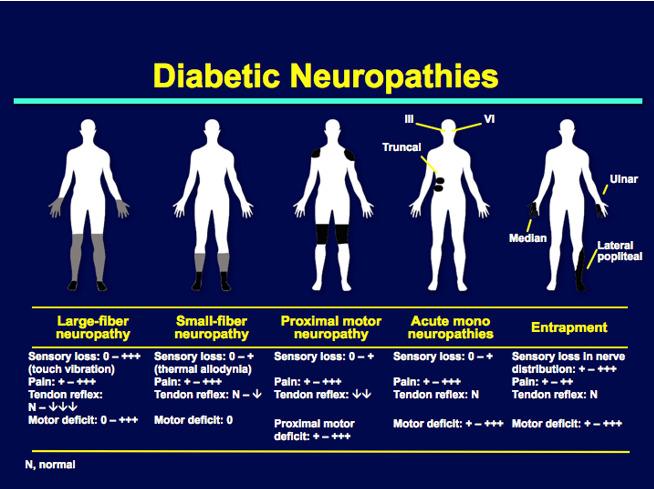 Expert Insights on Why NU NERVE Stands Out Among Neuropathy Remedies