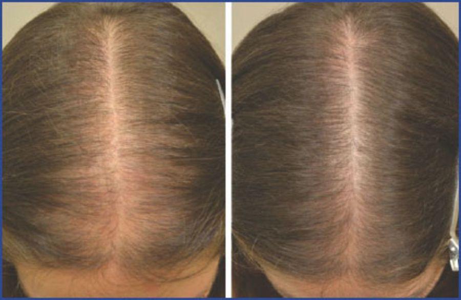 Maintaining Consistency and Patience for Lasting Results