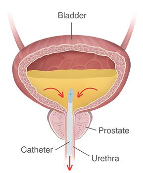 Boost Your Hydration Habits for Optimal Urine Flow