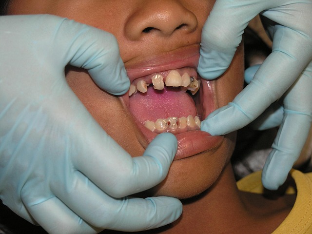 Remedies for Toothache That Actually Work