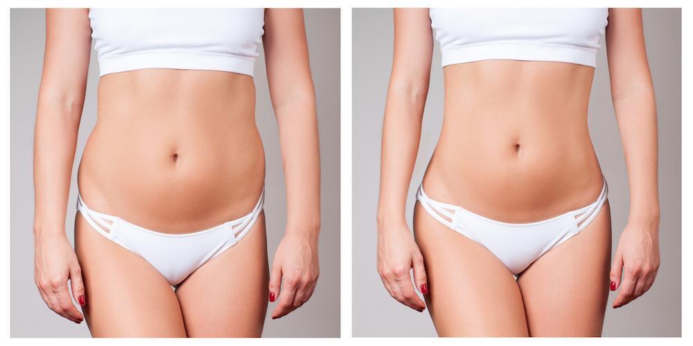Tracking Progress and Maintaining Consistency for a 4cm Reduction in 30 Days