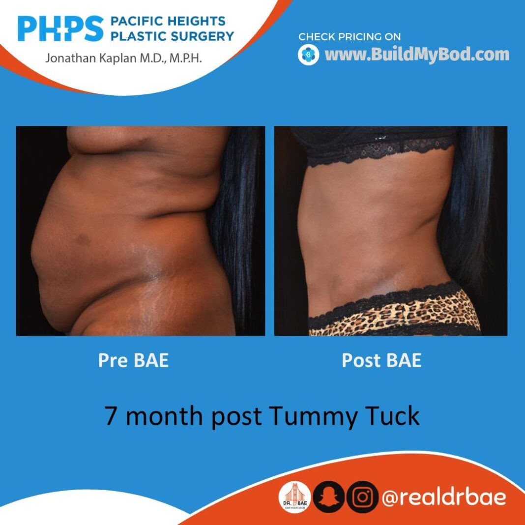 How to erase tummy bulge — drop 10cm in 45 days using blackberries