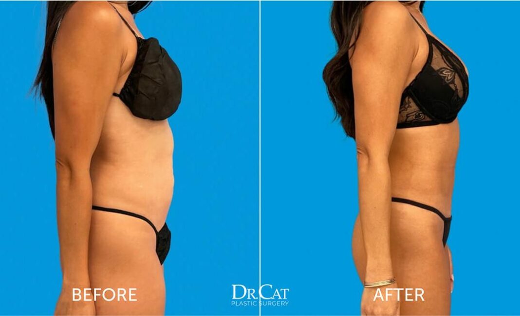 How to flatten your lower belly — drop 6cm in 6 months using bell peppers