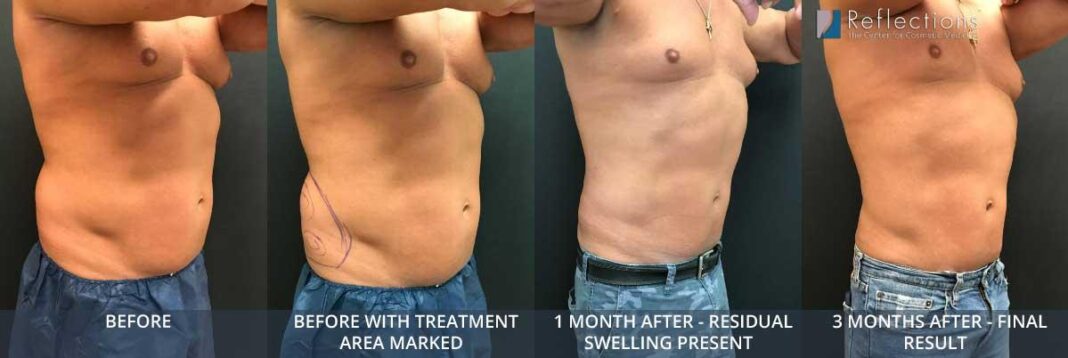 How to shrink love handles — drop 7cm in 90 days using spinach