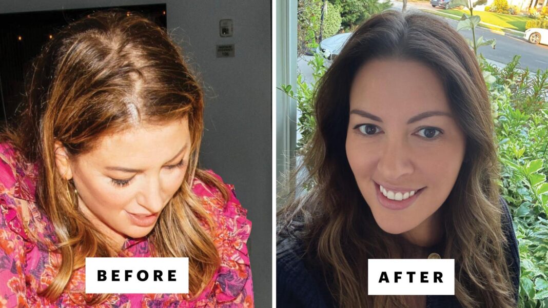 How to regrow thicker hair — add 2877 new strands in 45 days with collard greens