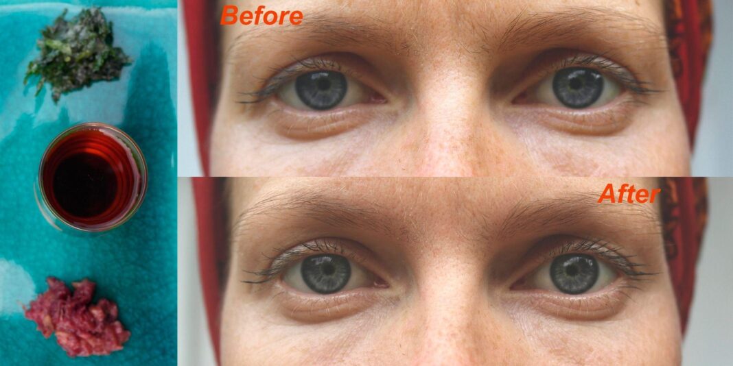 How to refresh tired eyes in 60 days with olive oil