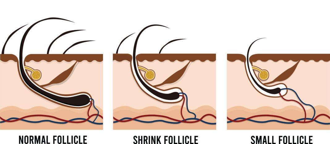 How to wake dormant follicles — add 3202 new strands in 6 months with cranberry