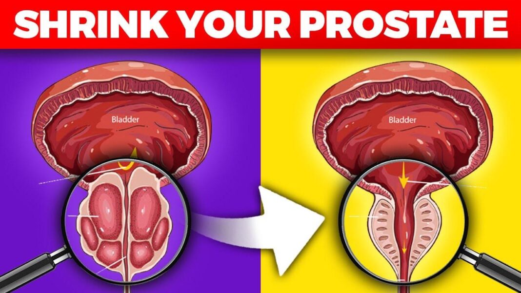 How to shrink prostate size in 7 days with grapefruit
