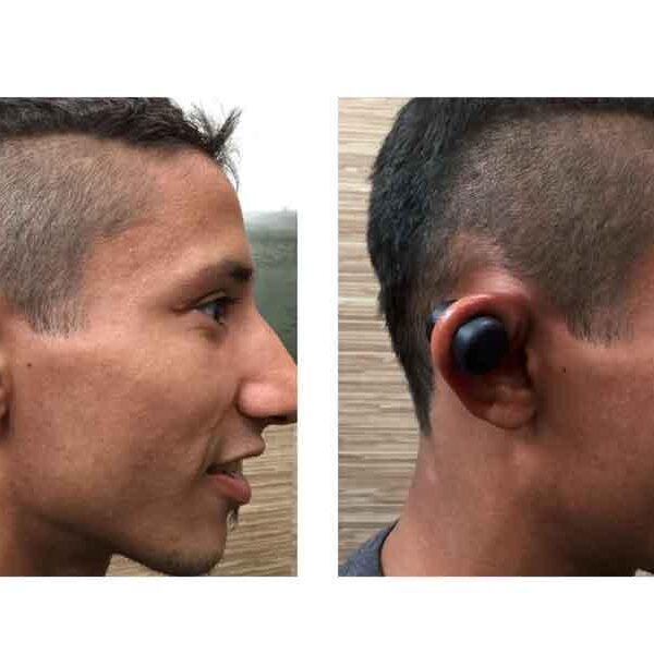 How to hear crisp sounds again in 3 months using cauliflower