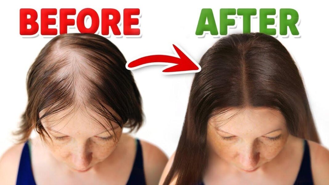 How to regrow thicker hair — add 2406 new strands in 90 days with salmon