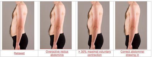 Long-Term Maintenance Strategies for Sustained Core Tightness Using Figs