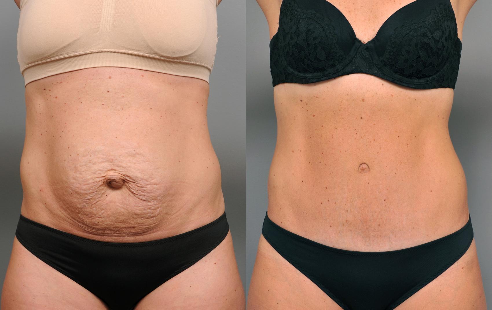 Scientific Insights into Sage's Effectiveness for Tummy Bulge Reduction
