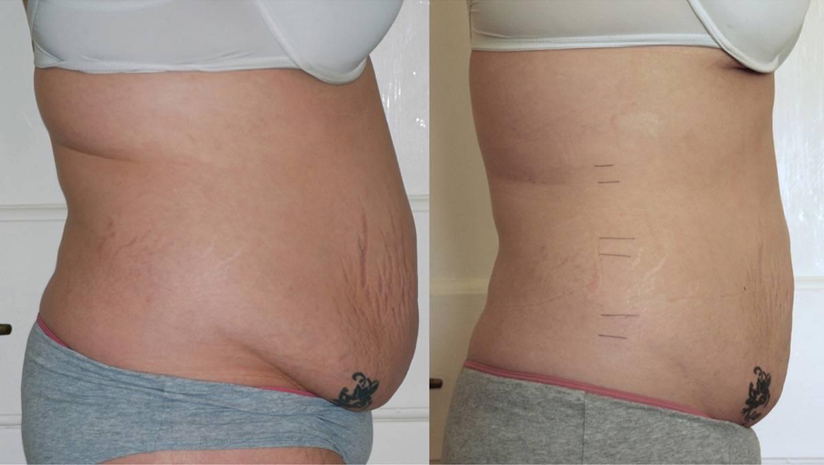 Combining Strawberries with Exercise for Optimal Waistline Results