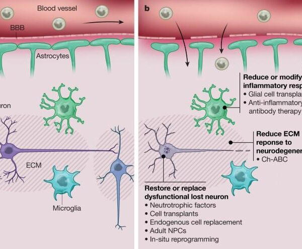 How to protect brain cells and boost brain power by 17% in 45 days with aloe vera juice