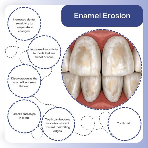 How to strengthen enamel by 3 shades in 21 days using cinnamon-honey mix
