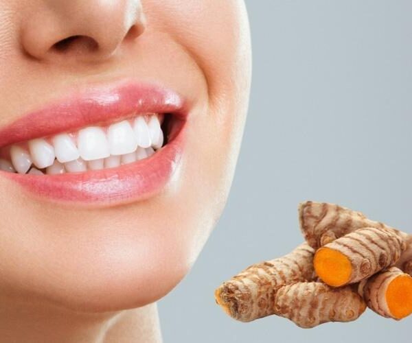 How to whiten teeth by 5 shades in 45 days using turmeric