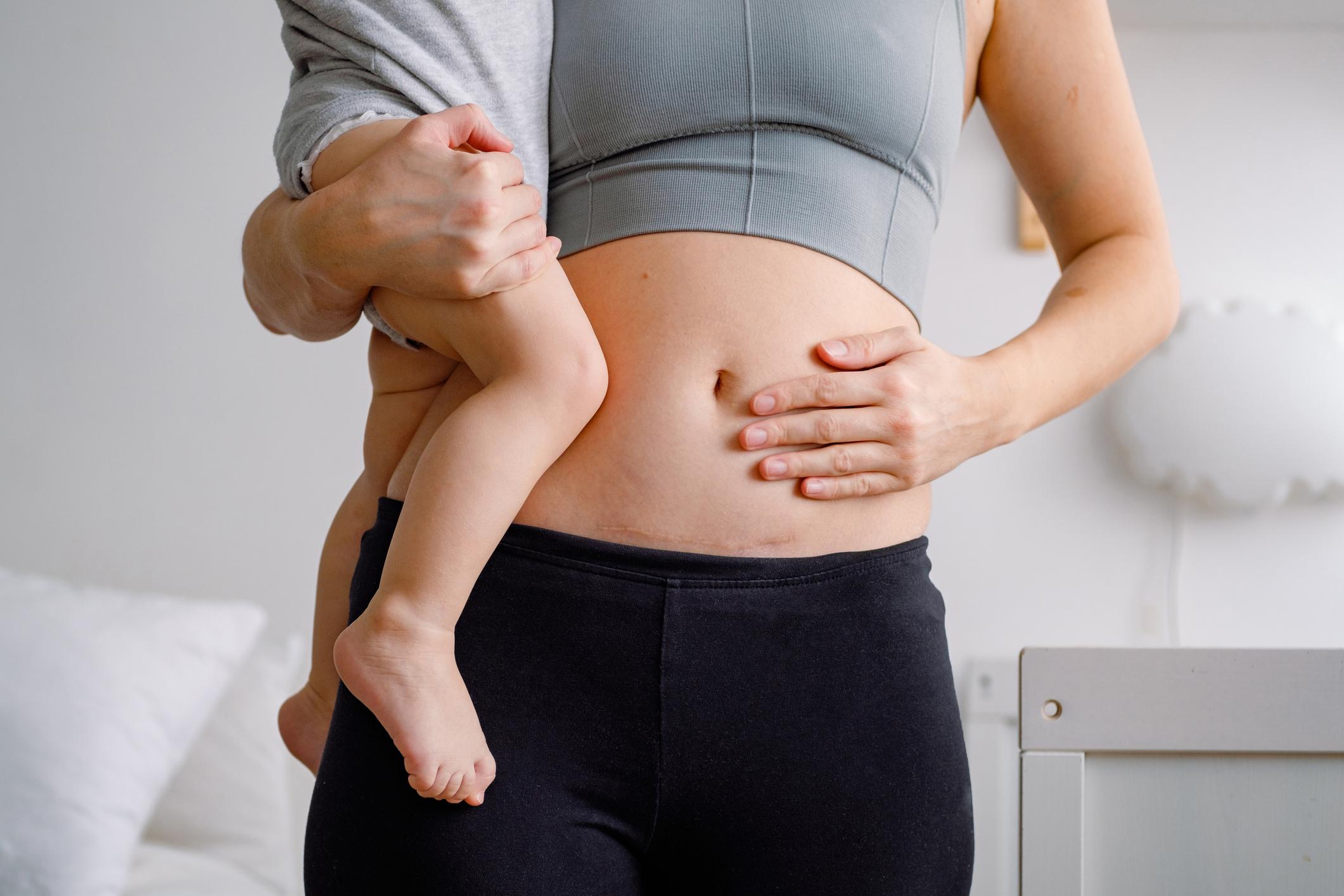 Incorporating Elderberry Into Your Daily Diet for Optimal Tummy Bulge Reduction