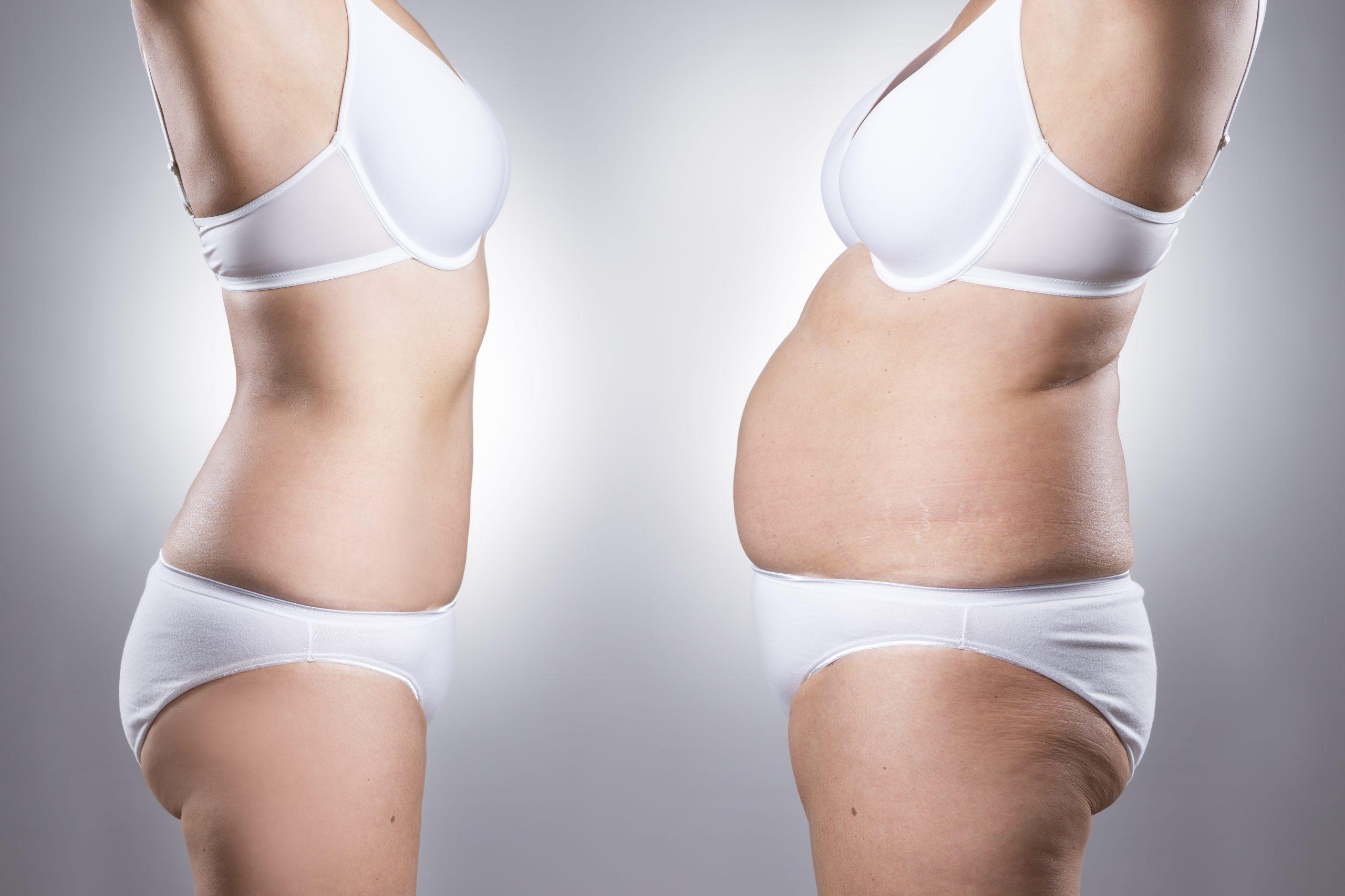 Torch Stubborn Fat: Lose 6kg in 90 Days with Walnuts