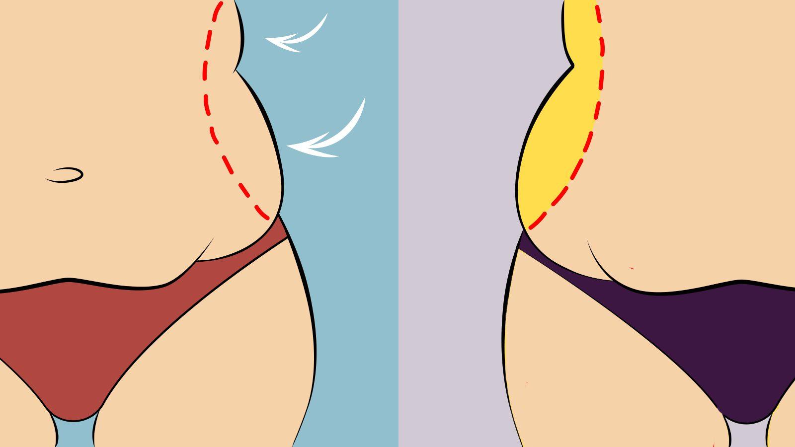 Understanding Love Handles and Their Causes